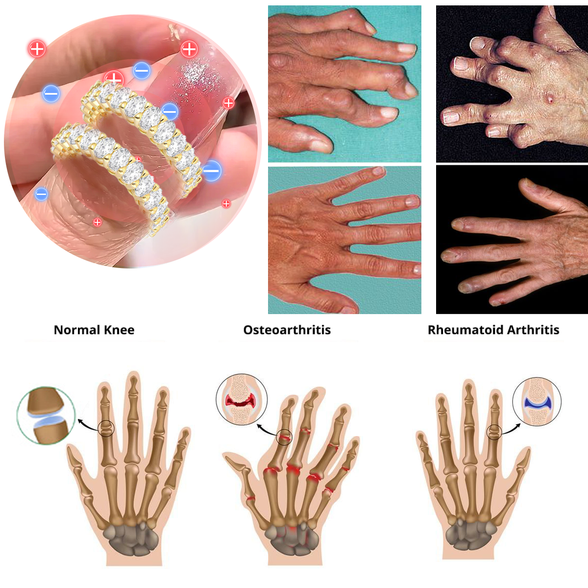 【 Official Brand Store 】Miniyou™Magnetology Diamond Moissanite  Ring（🌸 Spring Sale Starts Now! 🌸)